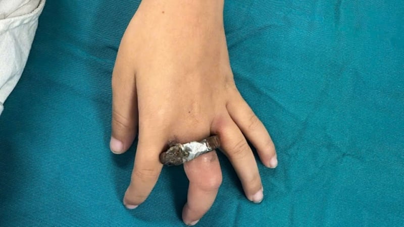 cho-ngon-tay-vao-vong-khoa-cua,-be-trai-6-tuoi-suyt-bi-hoai-tu-vi-nghich-dai