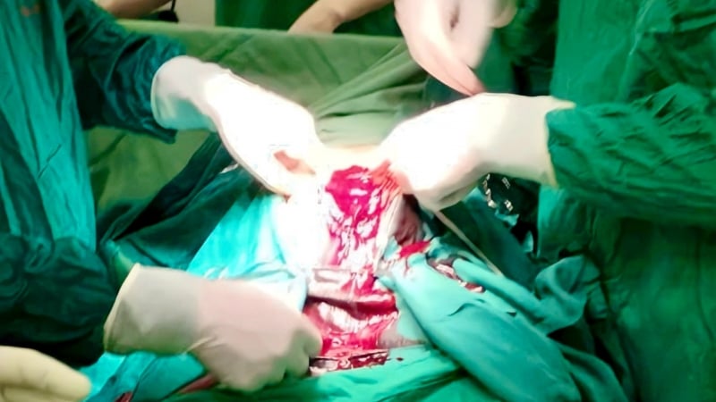 vo-tu-cung,-soc-mat-mau-sau-khi-tu-y-pha-thai-33-tuan