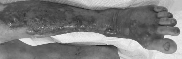 nguy-co-nhiem-khuan-an-thit-nguoi-tu-hai-san-song-va-nuoc-bien