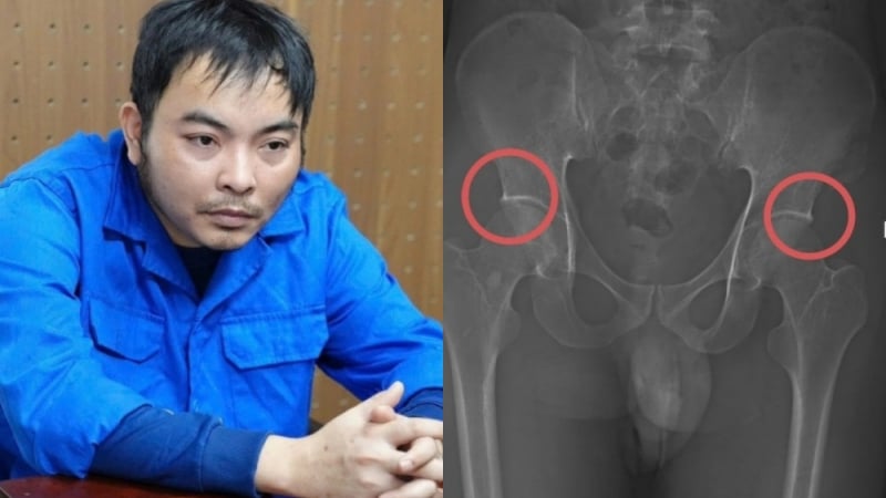 duong-day-co-y-duc-vo-xuong-khop-de-truc-loi:-lo-hong-nao-trong-quan-ly-bao-hiem-nhan-tho?