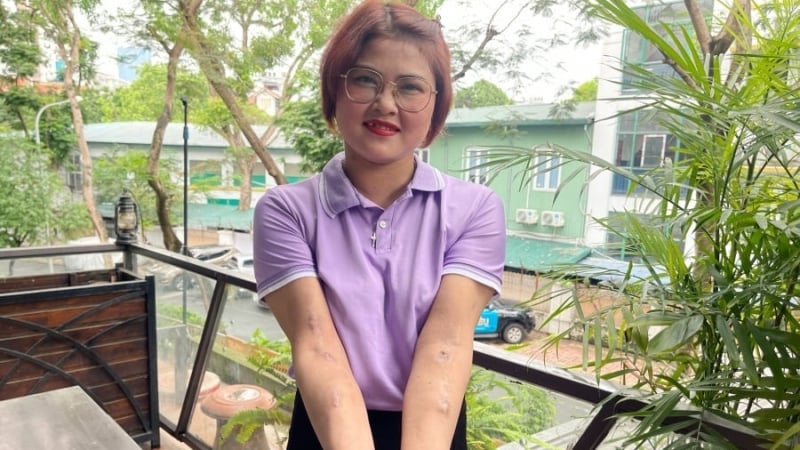 de-xuat-mien-vien-phi-som-voi-benh-nhan-chay-than:-noi-lo-khong-the-cho-den-2030