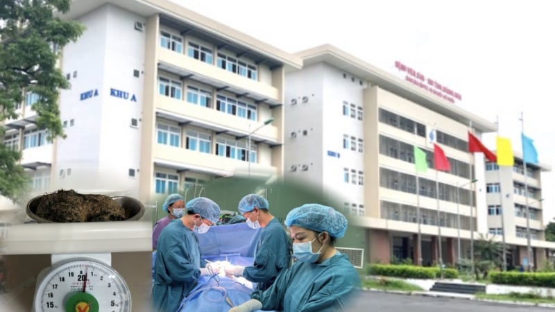 quang-ngai:-mo-lay-di-vat-la-bui-toc-“khung”-trong-da-day-cua-benh-nhi-6-tuoi