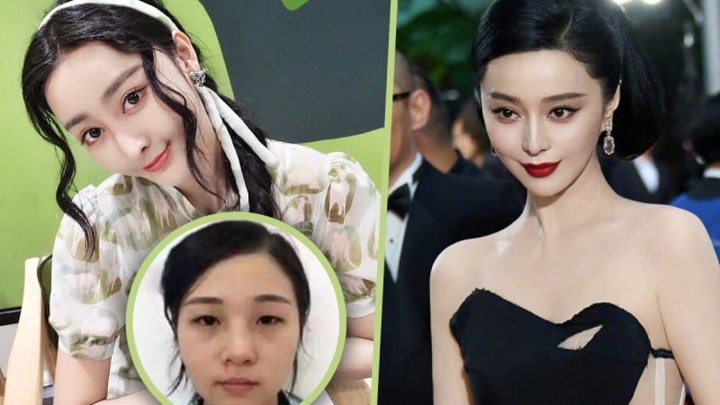 nguoi-phu-nu-chi-hon-29-ty-dong-phau-thuat-tham-my-de-giong-pham-bang-bang