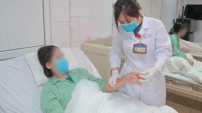 bong-nang-do-bon-cau-phat-no-khi-dang-thong-tac-bang-hoa-chat-gia-re-mua-tren-mang