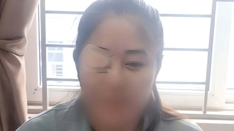 khon-kho-vi-roi-vao-canh-mat-tren-mat-duoi,-di-lai-kho-khan,-gap-thuc-an-cung-kho