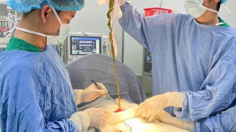 phat-hien-bui-toc-“nuot-tron”-da-day-be-trai-6-tuoi-khi-di-kham-vi-luoi-an