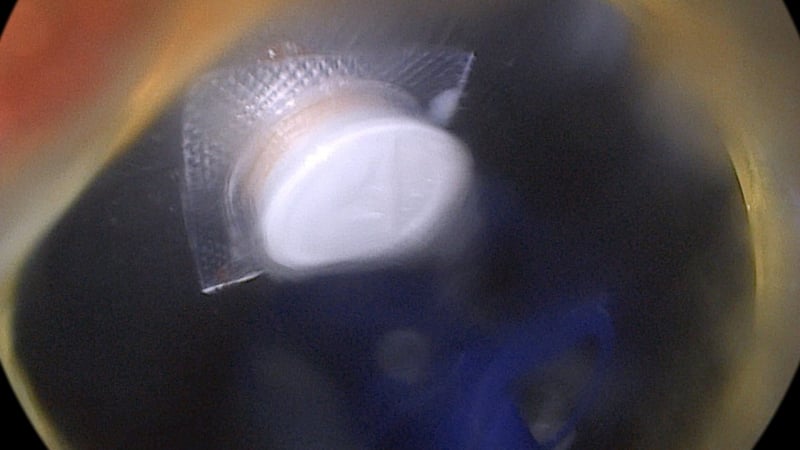 vua-uong-thuoc-vua-xem-ti-vi,-nguoi-dan-ong-mac-sai-lam-hiem-gap