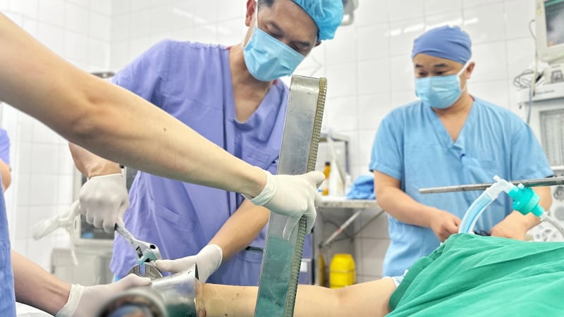 tai-nan-lao-dong-kinh-hoang-khien-benh-nhan-nhap-vien-cung-may-xay-thit