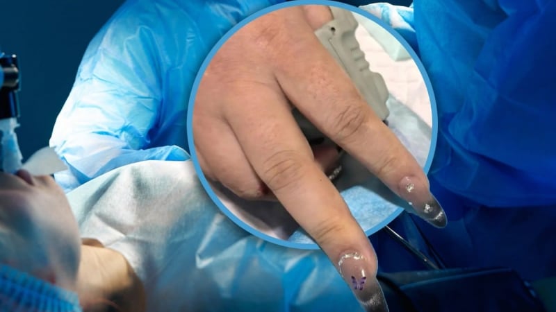 bo-mong-gia-khien-may-do-oxy-“bo-tay”,-bac-si-phai-goi-tho-lam-mong-vao-phong-cap-cuu