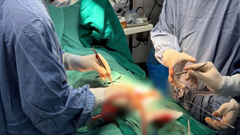 nguoi-dan-ong-nghien-ruou-tu-cat-dut-bo-phan-sinh-duc-trong-phut-mat-kiem-soat