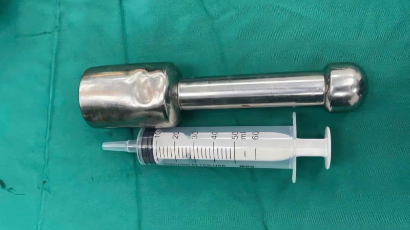 kho-tin:-chay-kim-loai-lon-nam-trong-truc-trang-1-thieu-nien,-bac-si-lam-du-cach-moi-loi-ra