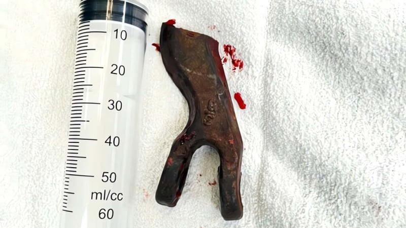 day-sat-dut-khi-keo-xe-qua-vung-lay,-lai-xe-bi-di-vat-lon-cam-vao-mat,-nguy-kich