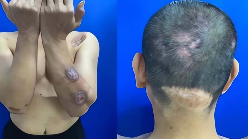 nguoi-dan-ong-tu-cao-cau-suot-20-nam,-bac-si-khuyen-di-kham-chuyen-khoa-tam-than