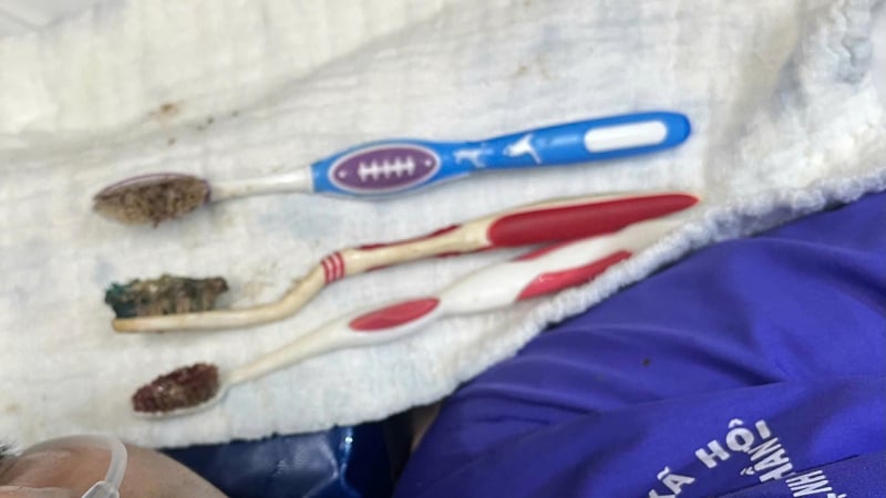 3-ban-chai-danh-rang-nam-trong-duong-tieu-hoa-cua-nam-thanh-nien-29-tuoi