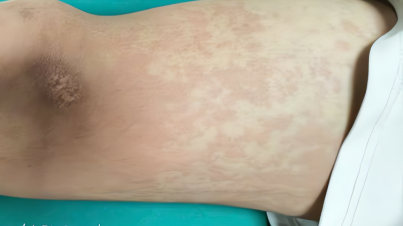 an-2-con-ve-sau,-nam-sinh-nhap-vien-khan-cap