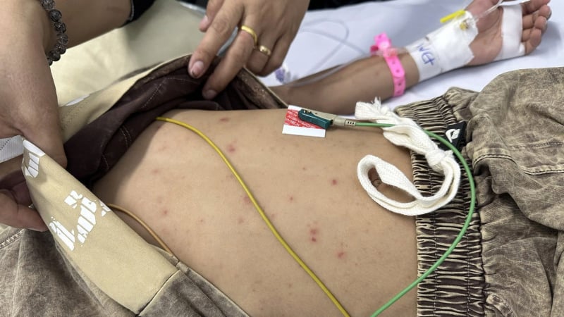 bach-cau-tang-vot-8-lan,-tu-ban-lan-khap-nguoi:-be-trai-7-tuoi-vua-duoc-hoi-sinh-ngoan-muc