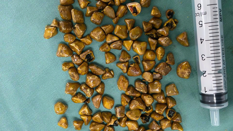 soi-mat-nhu-voc-ngo-vang-ong-khien-bac-si-cung-kinh-ngac